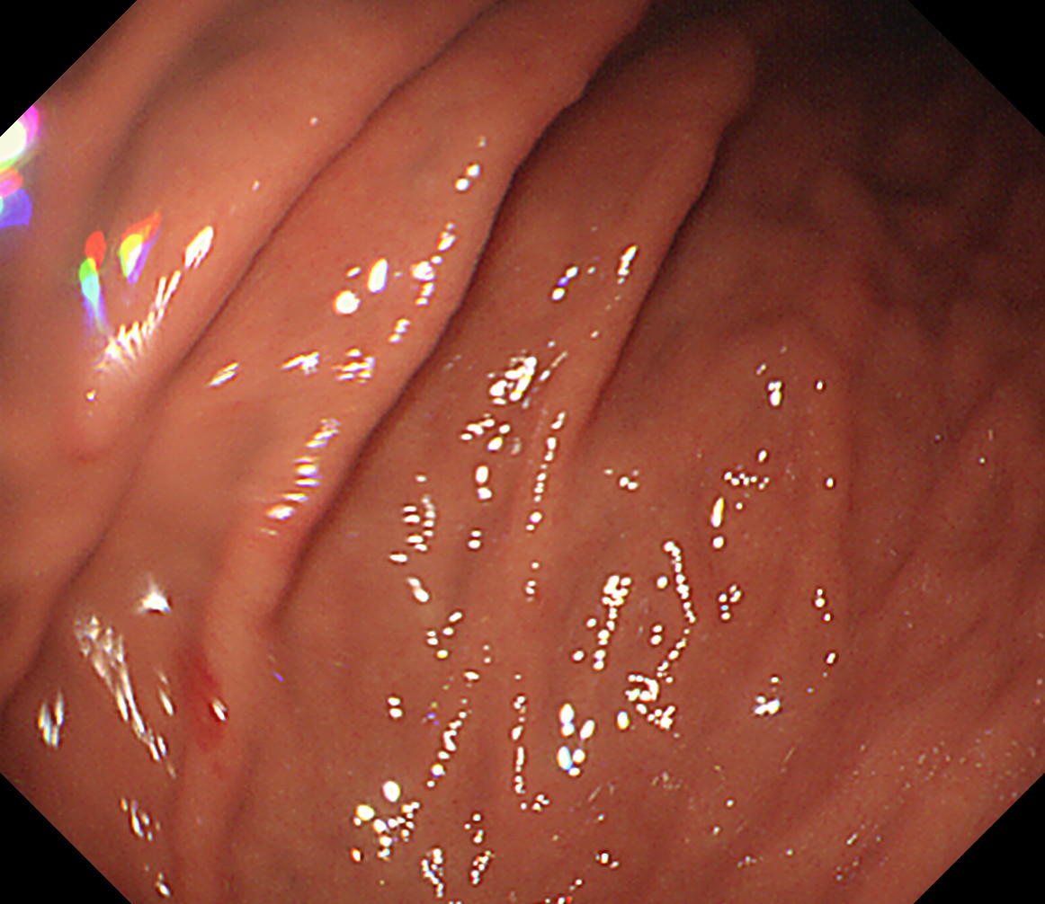 �̉����O��